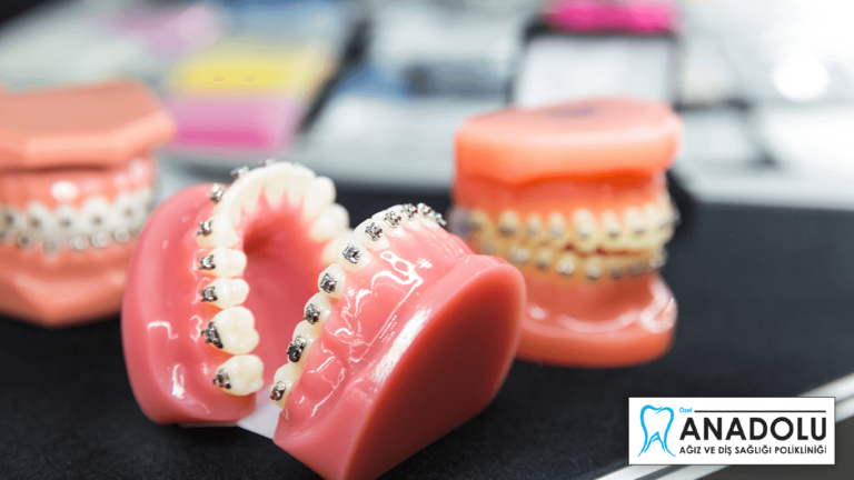 Kartal ortodonti diş tedavisi Anadolu Diş Sağlığı Polikliniği
