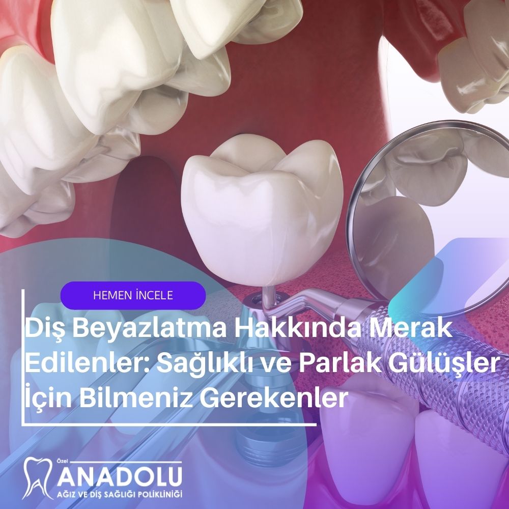 implant tedavisi aşamaları